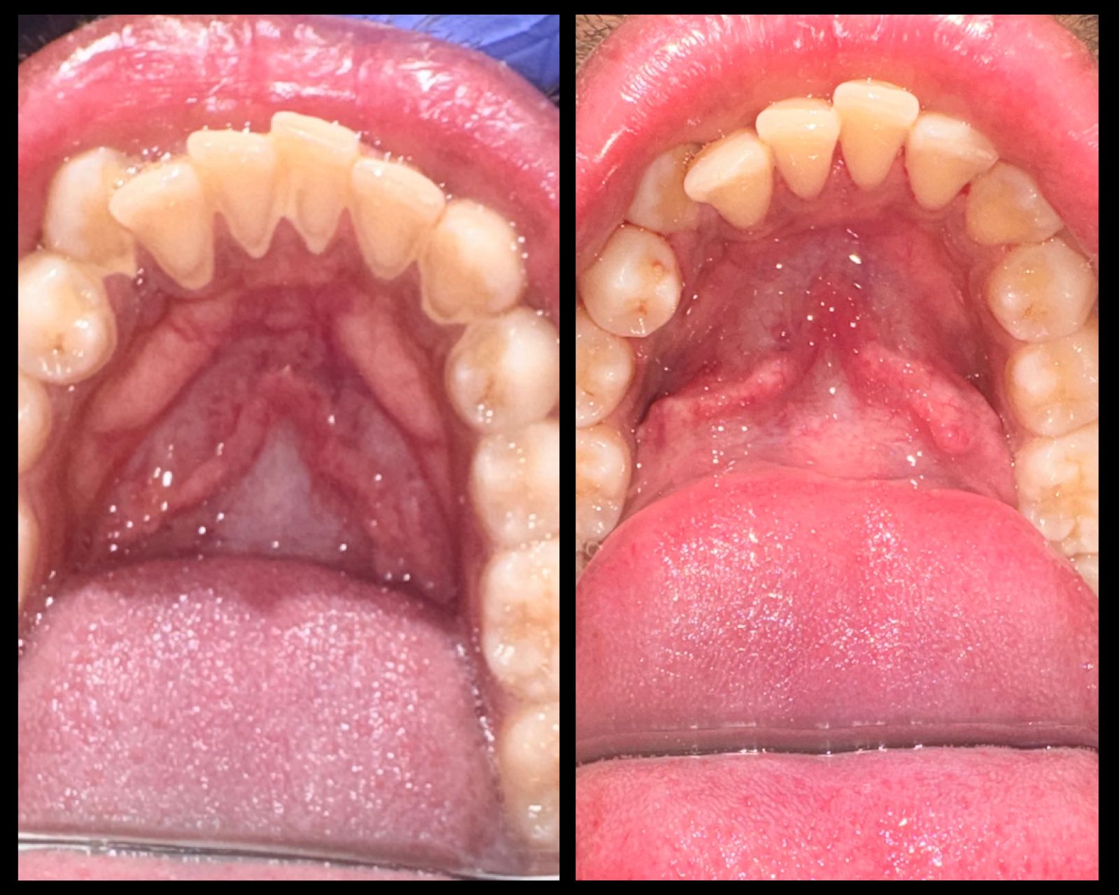 Clinical before and after transformation 4
